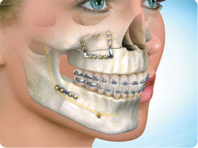 Oral, Dental and Maxillofacial Surgery