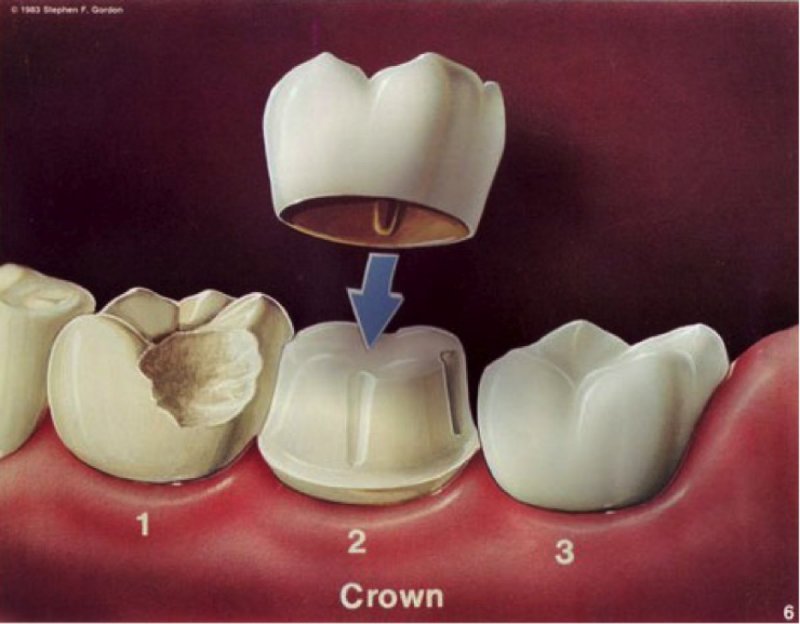 Prosthetic Dentistry 